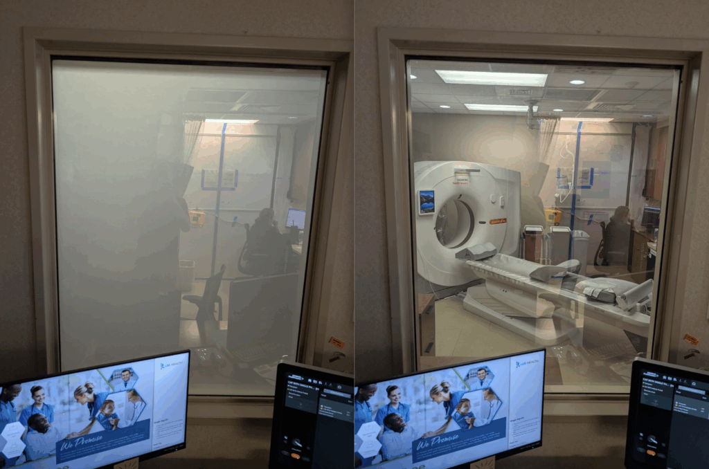 PRIWATT for Lee Health MRI